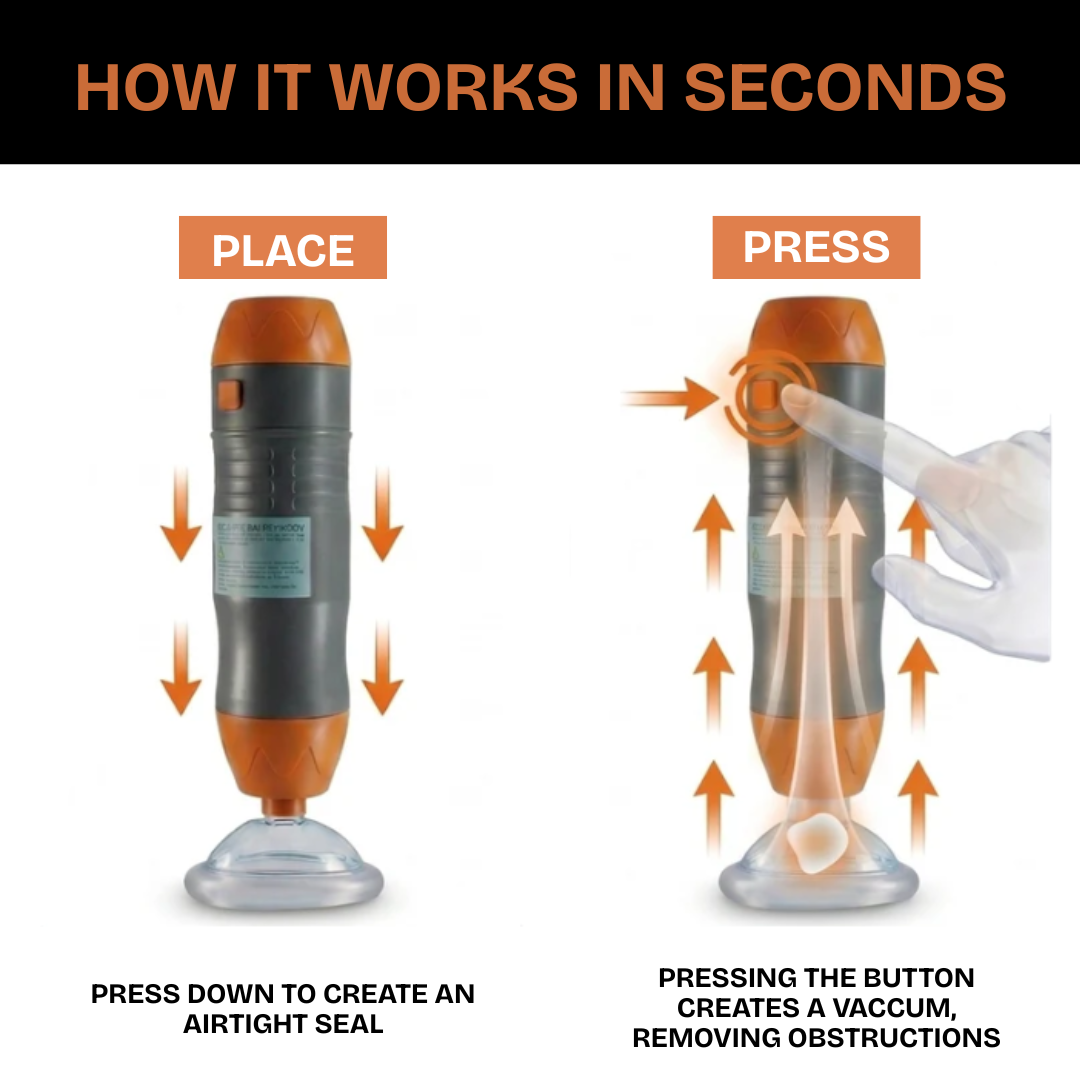 One-Button Anti-Choking Device